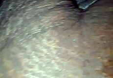 I have no hair and I am sucking and being fucked hard by my husband
