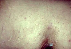 Anal pleasure with a medical anal speculum and dilator