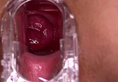 Close up and very tender on the outside, and completely bald on the inside